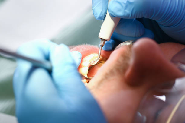 Best Urgent Tooth Repair  in Anton, TX