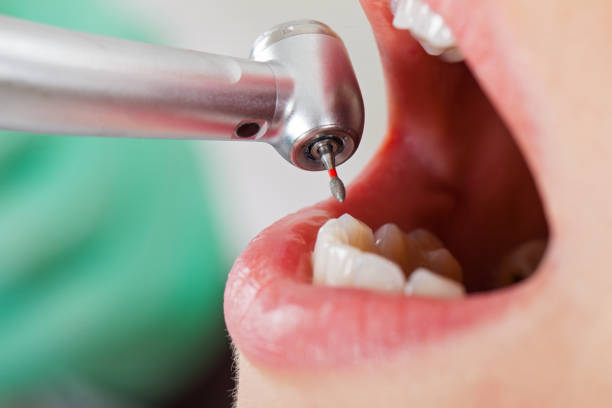 Best Emergency Tooth Extraction  in Anton, TX